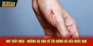 Mơ Thấy Máu - Những Dự Báo Về Tài Chính Và Sức Khỏe Bạn