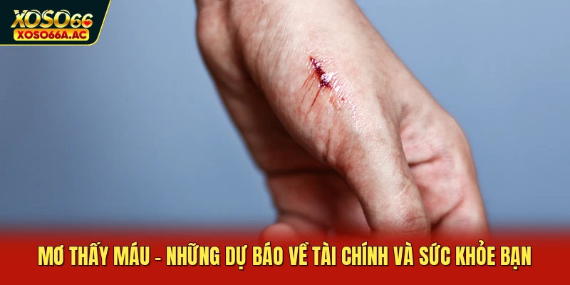 Mơ Thấy Máu - Những Dự Báo Về Tài Chính Và Sức Khỏe Bạn
